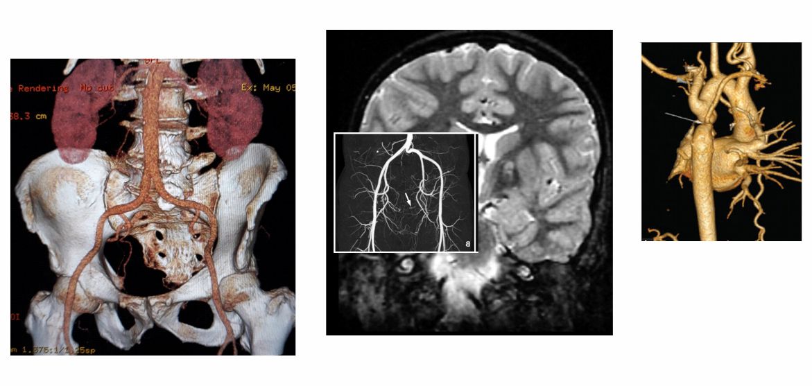 Ακτινοανατομία (CT, MRI, PET, SPECT)