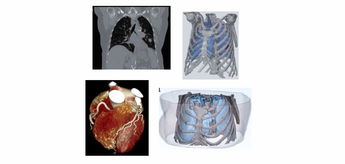 Σύγχρονες εφαρμογές στην CT