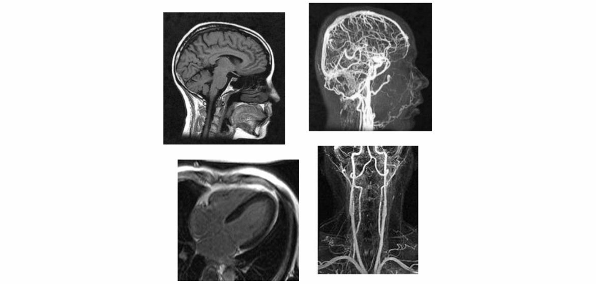 Σύγχρονες εξελίξεις στη MRI