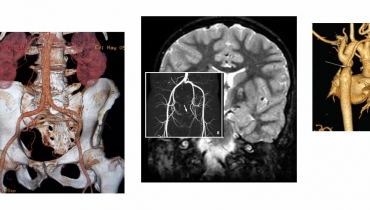 Ακτινοανατομία (CT, MRI, PET, SPECT)