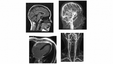 Σύγχρονες εξελίξεις στη MRI